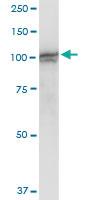 Anti-PGBD1 Polyclonal Antibody Pair