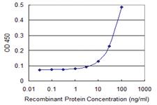 Anti-TTC4 Mouse Monoclonal Antibody [clone: 1E10]