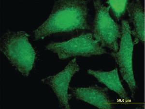 Anti-PRKAG2 Mouse Monoclonal Antibody [clone: 3C4]