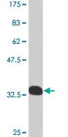 Anti-SMARCB1 Mouse Monoclonal Antibody [clone: 2H1]