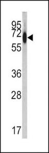 Anti-ALB Rabbit Polyclonal Antibody