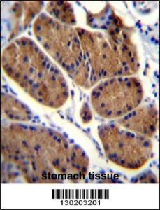 Anti-NDUFS8 Rabbit Polyclonal Antibody (FITC (Fluorescein Isothiocyanate))