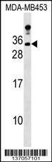 Anti-LIN7A Rabbit Polyclonal Antibody (FITC (Fluorescein Isothiocyanate))