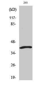 Western blot analysis of various cells using Anti-DFF45 (cleaved Asp224) Antibody