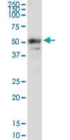 Anti-MMP3 Rabbit Polyclonal Antibody