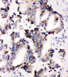 Anti-IRAK2 Rabbit Antibody