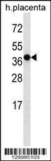 Anti-OR5H2 Rabbit Polyclonal Antibody (Biotin)