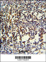 Anti-ANKRD49 Rabbit Polyclonal Antibody (AP (Alkaline Phosphatase))