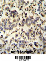 Anti-C6orf58 Rabbit Polyclonal Antibody