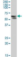 Anti-THRA Goat Polyclonal Antibody