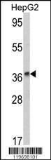 Anti-ADH1B Rabbit Polyclonal Antibody