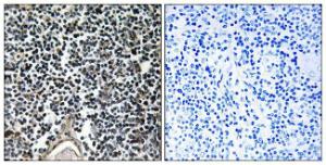 Immunohistochemical analysis of paraffin-embedded human thymus gland using Anti-ABCB7 Antibody The right hand panel represents a negative control, where the antibody was pre-incubated with the immunising peptide