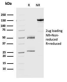 SDS-PAGE analysis of Anti-Geminin Antibody [CPTC-GMNN-1] under non-reduced and reduced conditions; showing intact IgG and intact heavy and light chains, respectively. SDS-PAGE analysis confirms the integrity and purity of the antibody