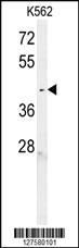 Anti-C6orf58 Rabbit Polyclonal Antibody