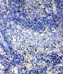 Anti-IRAK2 Rabbit Antibody