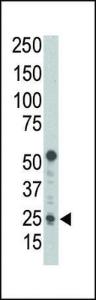 Anti-BBC3 Rabbit polyclonal antibody