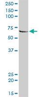 Anti-MMP3 Rabbit Polyclonal Antibody