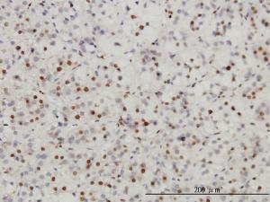 Anti-SAE1 Mouse Monoclonal Antibody [clone: 1G4-1G5]