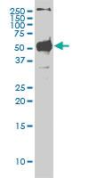 Anti-STK38 Mouse Monoclonal Antibody [clone: 2G8-1F3]