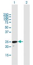 Anti-H1FOO Mouse Polyclonal Antibody