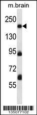 Anti-MAP4K4 Rabbit Polyclonal Antibody (Biotin)