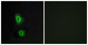 Antibody anti-OR4C16 A99530-100 100 µg