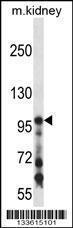 Anti-COL1A1 Rabbit Polyclonal Antibody (AP (Alkaline Phosphatase))