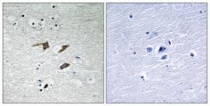 Immunohistochemical analysis of paraffin-embedded human brain tissue using Anti-FAK Antibody. The right hand panel represents a negative control, where the antibody was pre-incubated with the immunising peptide