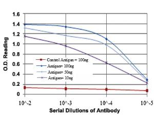 Anti-MSI1 Mouse Monoclonal Antibody [clone: 2A12]