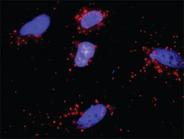 Anti-RALBP1 + TRAF2 Antibody Pair