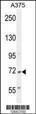 Anti-ALS2CR11 Rabbit Polyclonal Antibody (FITC (Fluorescein Isothiocyanate))