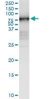 Anti-MMP3 Rabbit Polyclonal Antibody