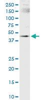 Anti-SMARCB1 Polyclonal Antibody Pair