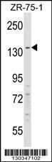 Anti-RFX1 Rabbit Polyclonal Antibody (AP (Alkaline Phosphatase))