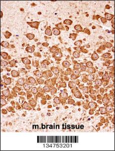 Anti-DAPK3 Rabbit Polyclonal Antibody (FITC (Fluorescein Isothiocyanate))