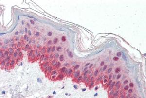 Anti-P4HA1 Antibody (A83360) (5 µg/ml) staining of paraffin embedded Human Skin. Steamed antigen retrieval with citrate buffer pH 6, AP-staining