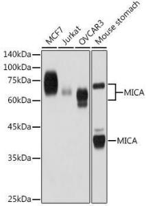 Western blot analysis of extracts of various cell lines, using Anti-MICA Antibody [ARC2422] (A306195) at 1:1,000 dilution The secondary antibody was Goat Anti-Rabbit IgG H&L Antibody (HRP) at 1:10,000 dilution Lysates/proteins were present at 25 µg per lane