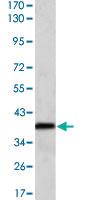 Anti-MSI1 Mouse Monoclonal Antibody [clone: 2A12]