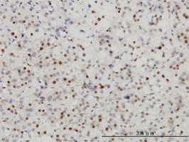 Anti-SAE1 Mouse Monoclonal Antibody [clone: 1G4-1G5]