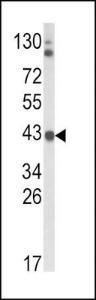 Anti-ADH5 Rabbit Polyclonal Antibody (PE (Phycoerythrin))