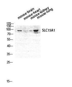 Western blot analysis of mouse brain, mouse heart, mouse lung, and mouse kidney cells using Anti-SLC15A1 Antibody