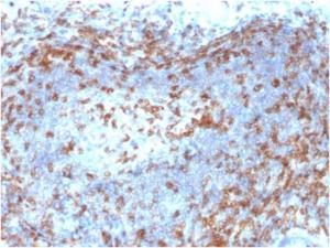 Anti-ZAP70 antibody