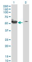 Anti-STK38 Mouse Monoclonal Antibody [clone: 2G8-1F3]