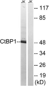 Western blot analysis of lysates from Jurkat cells using Anti-CtBP1 Antibody. The right hand lane represents a negative control, where the antibody is blocked by the immunising peptide