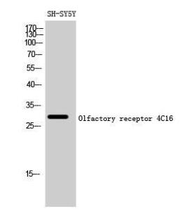 Antibody anti-OR4C16 A99530-100 100 µg