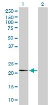 Anti-FAU Rabbit Polyclonal Antibody