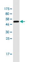 Anti-LGALS3 Mouse Monoclonal Antibody [clone: 3G8]