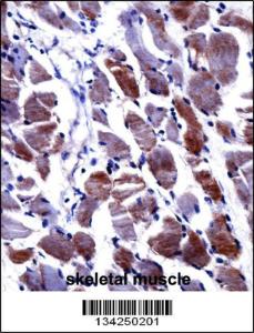 Anti-DPYSL3 Rabbit Polyclonal Antibody