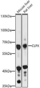 Anti-CLPX antibody