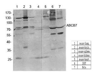 Western blot analysis of various cells using Anti-ABCB7 Antibody